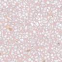 Fliese Porphyr rosa - AR0211012